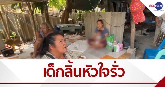 หนูน้อย 1 ขวบ ลิ้นหัวใจรั่ว ไม่มีเงินรักษา